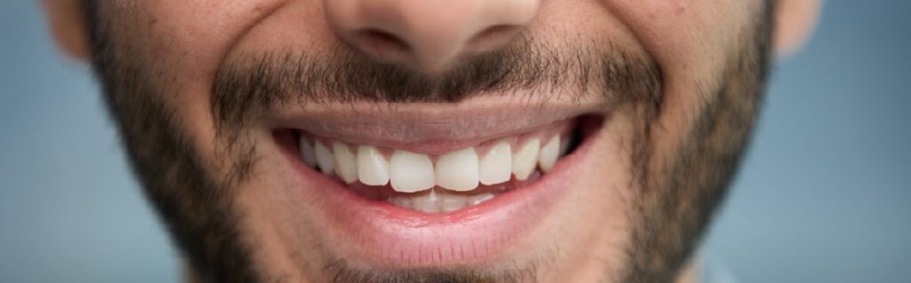 Smile With Confidence