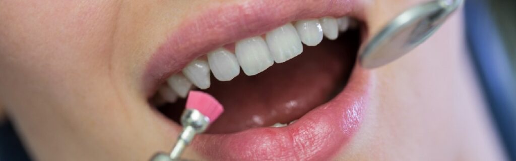 deep tooth cleaning