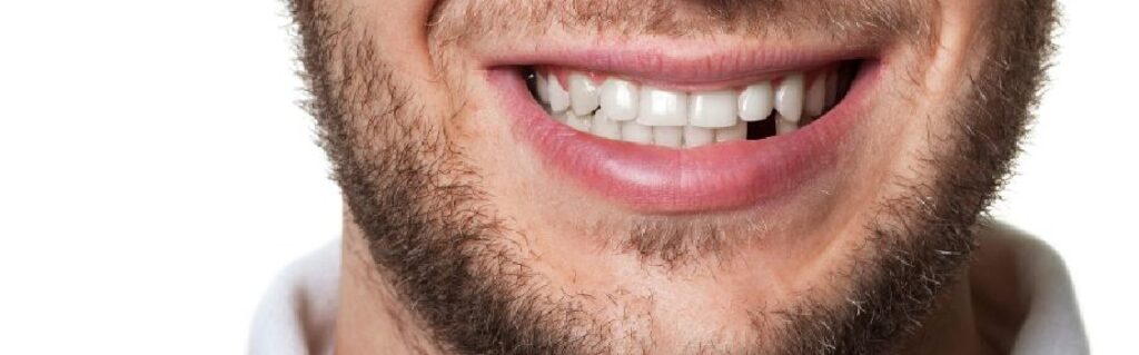 best solution for missing teeth