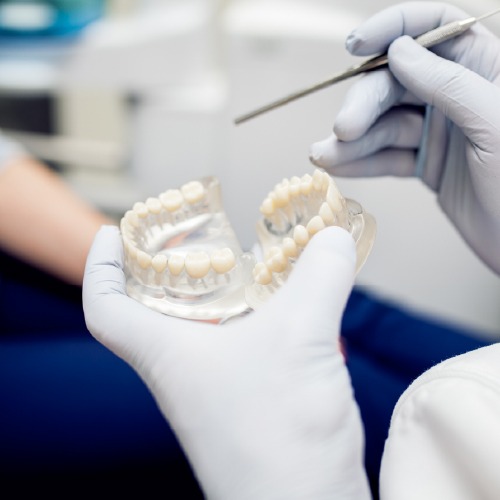 All on 4 dental implant technique