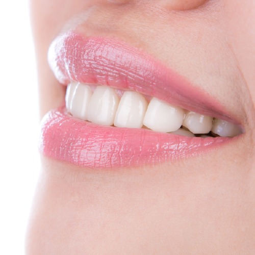 Smile With Confidence