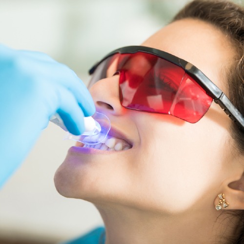 professional teeth whitening