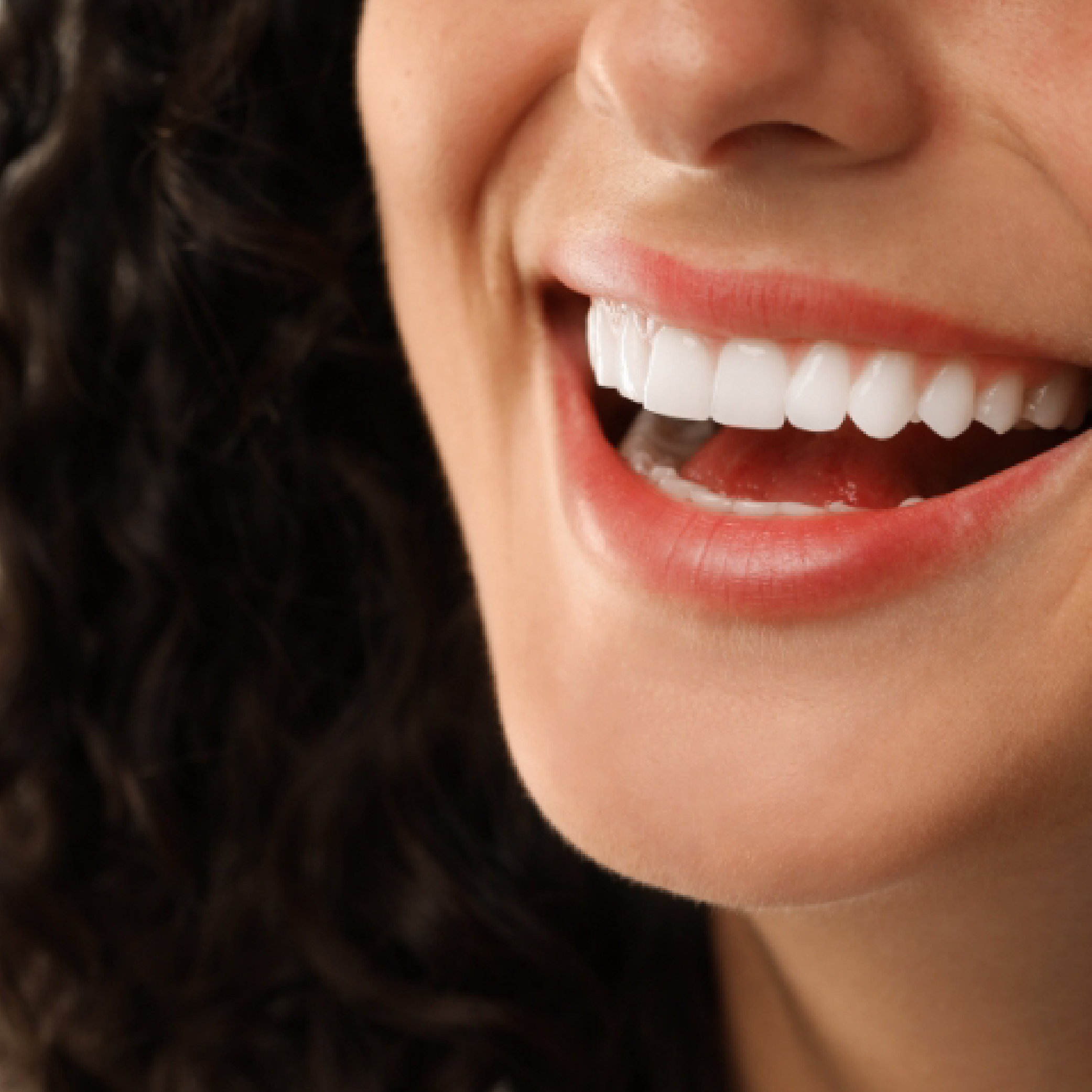 hollywood smile makeover