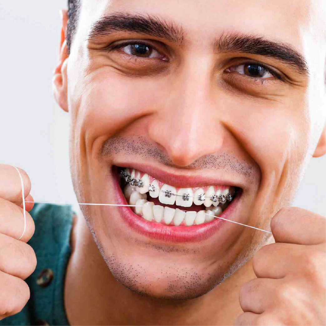 dental braces options for adults