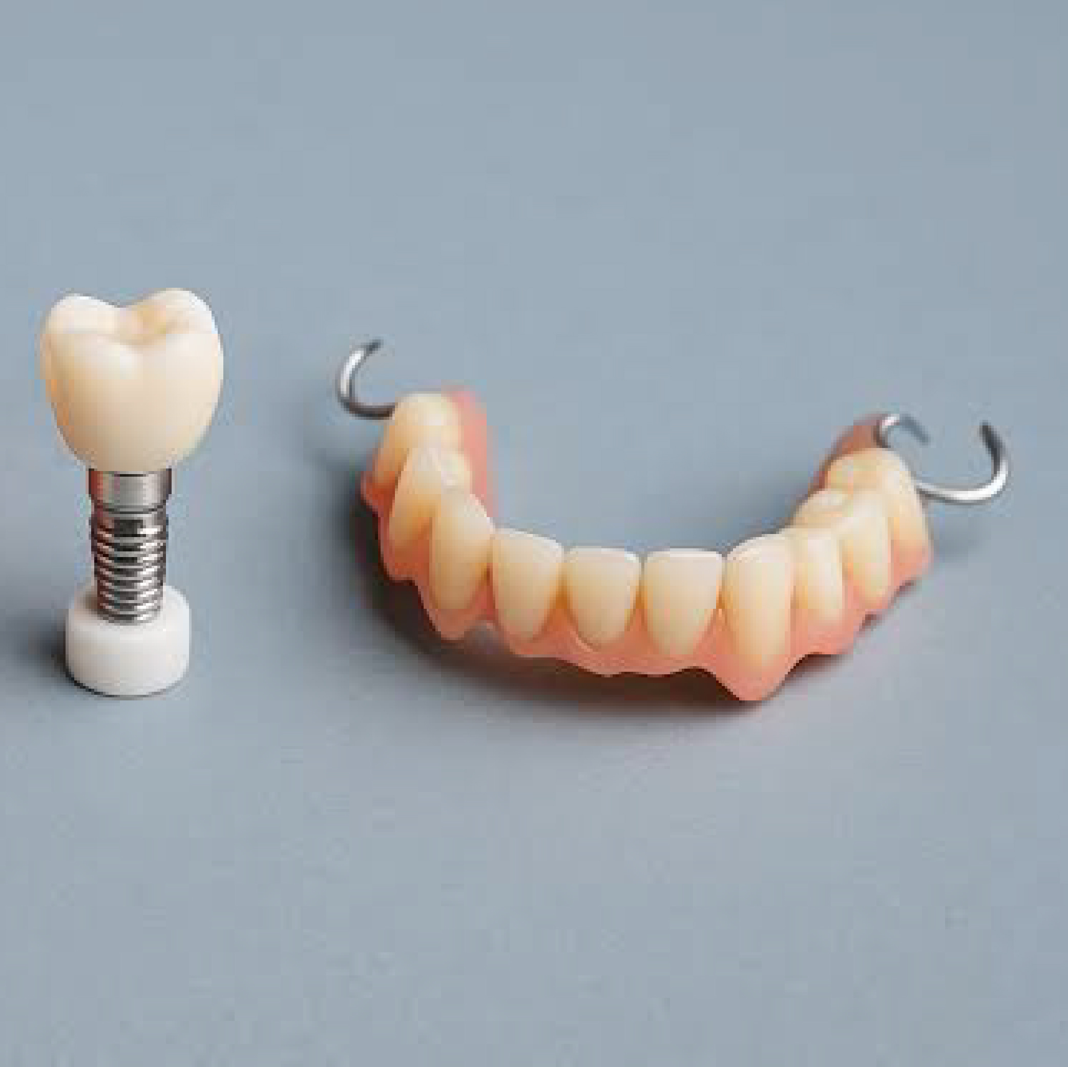 the best solution for missing teeth