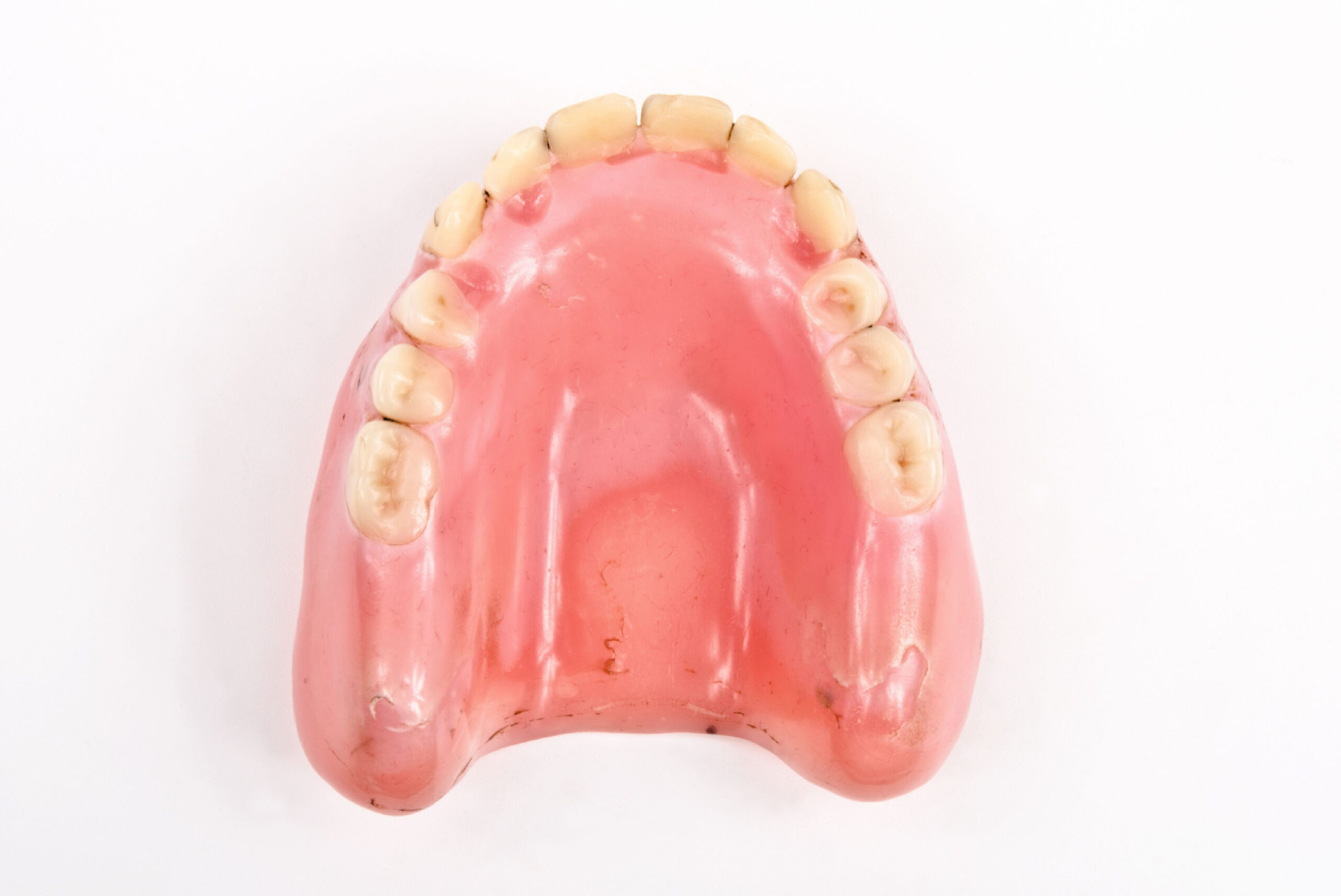 cracked molar tooth